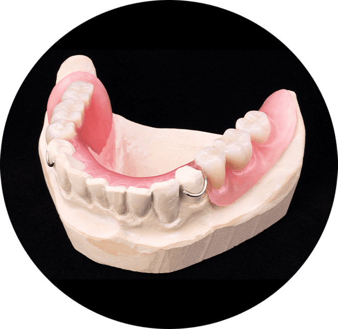 partial denture model